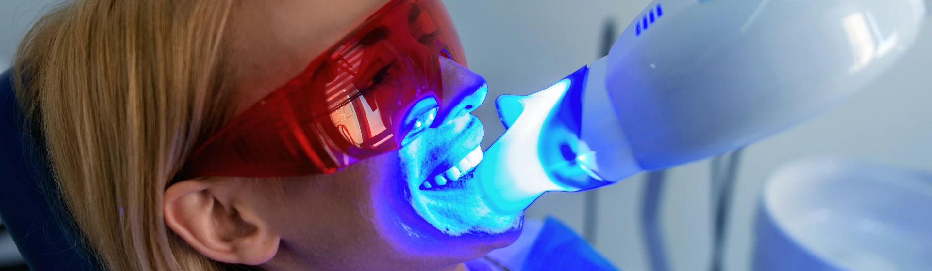 Відбілювання зубів Magic Smile