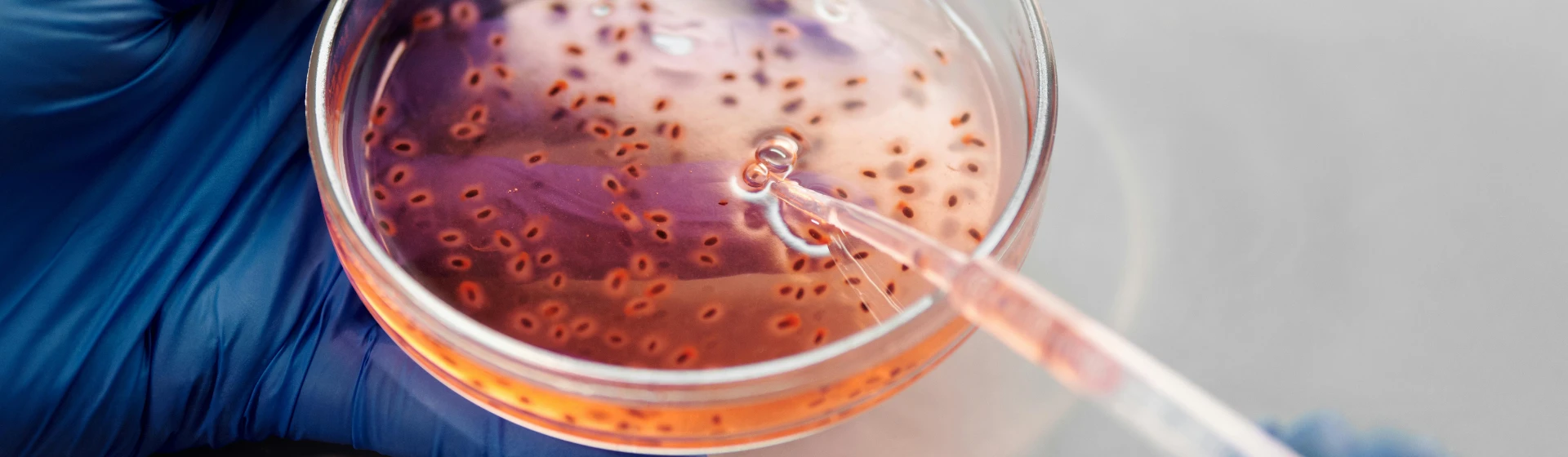 Тестування на Helicobacter pylori