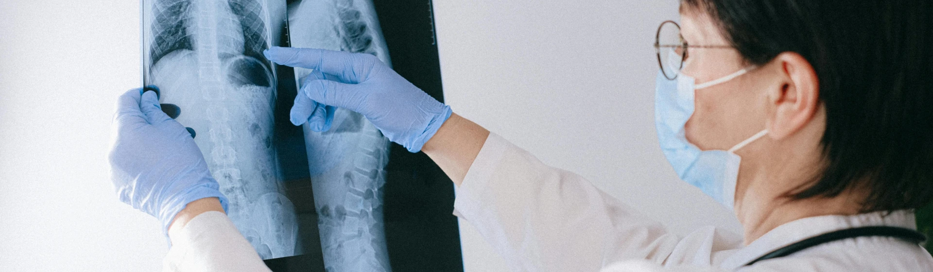 Рентген органов грудной клетки