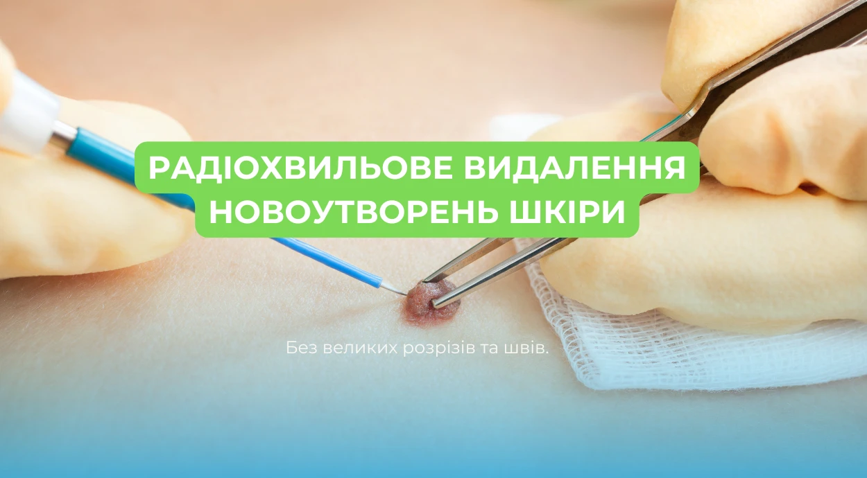Радиоволновое удаление новообразований на коже
