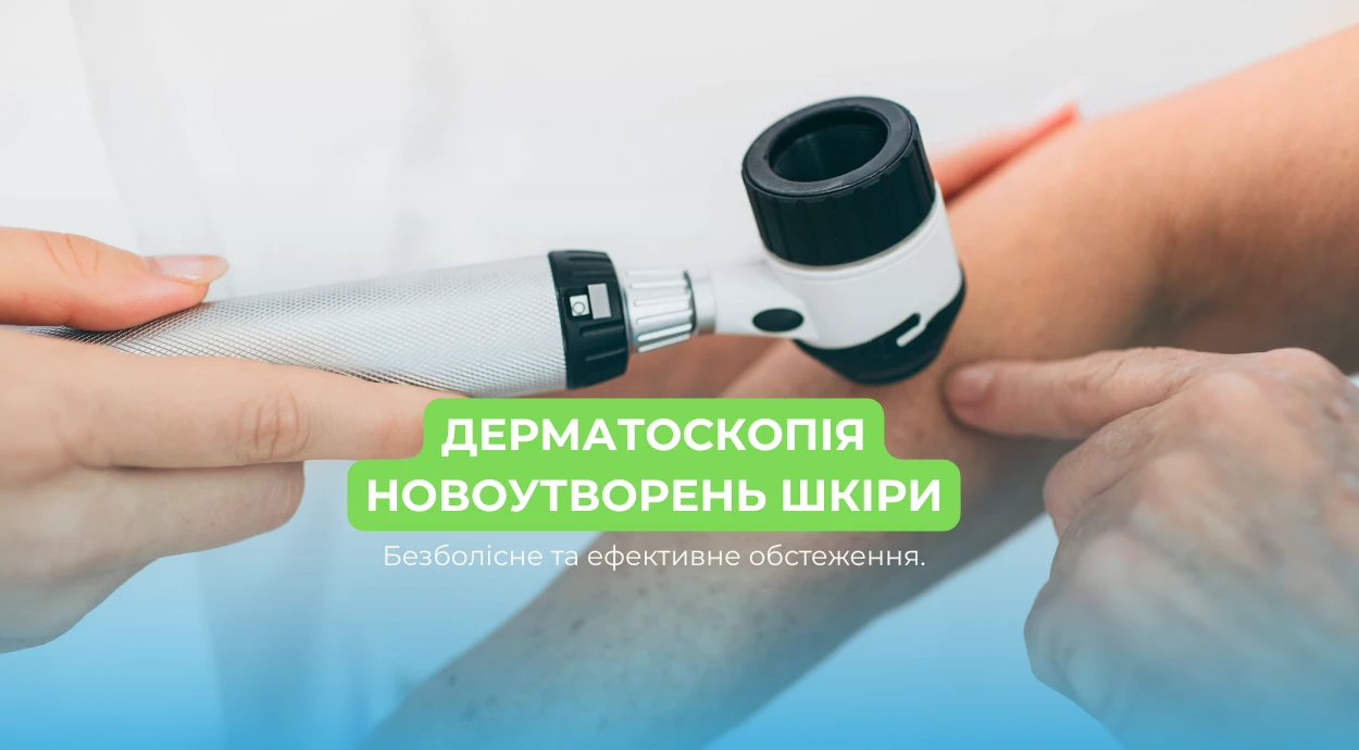 Дерматоскопия новообразований кожи