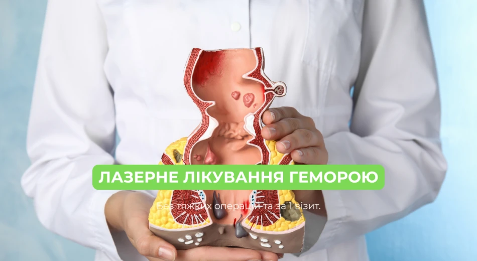 Лазерное лечение геморроя за 1 визит