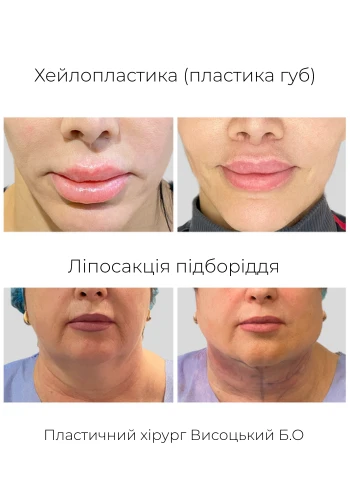 Висоцький Богдан Олегович
