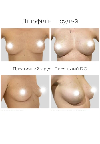 Висоцький Богдан Олегович