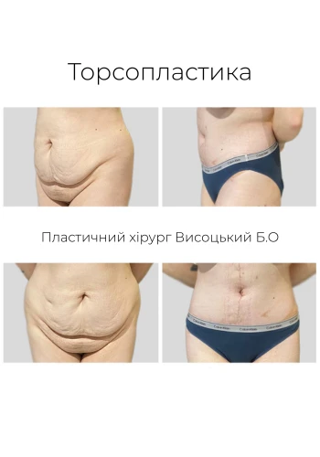 Висоцький Богдан Олегович