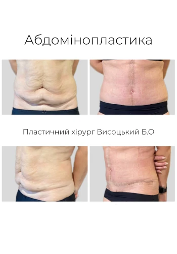 Висоцький Богдан Олегович